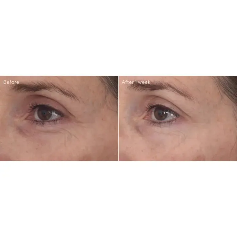 Murad Retinal ReSculpt Eye Treatment